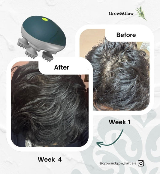 Grow & Glow Electric Scalp Massager