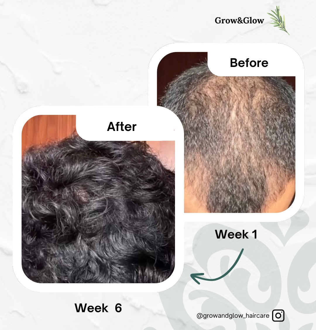 Grow & Glow Hair Growth Oil - 100ml